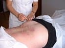 Acupuncture Sino Santé — photo 1